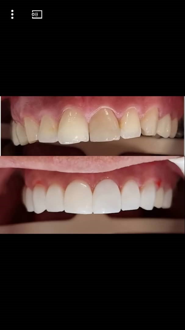 118 برتر ایران