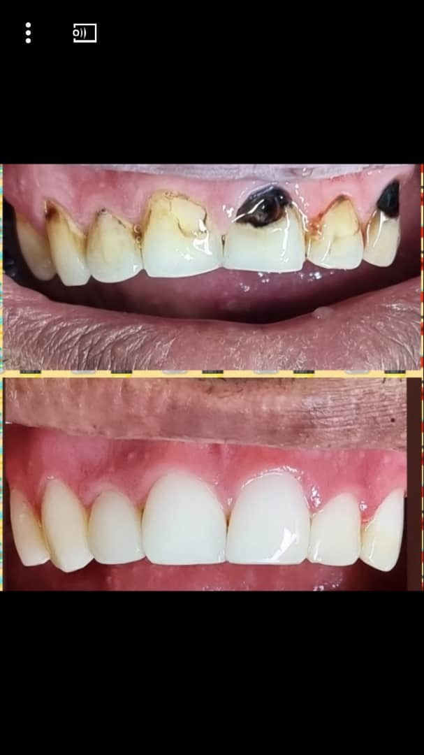 118 برتر ایران