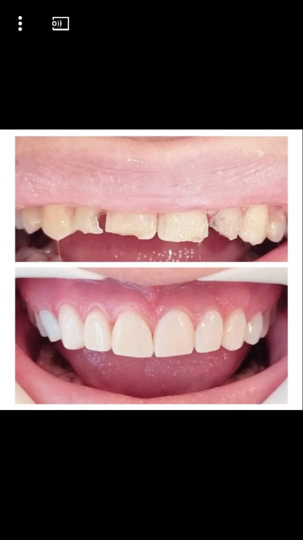 118 برتر ایران