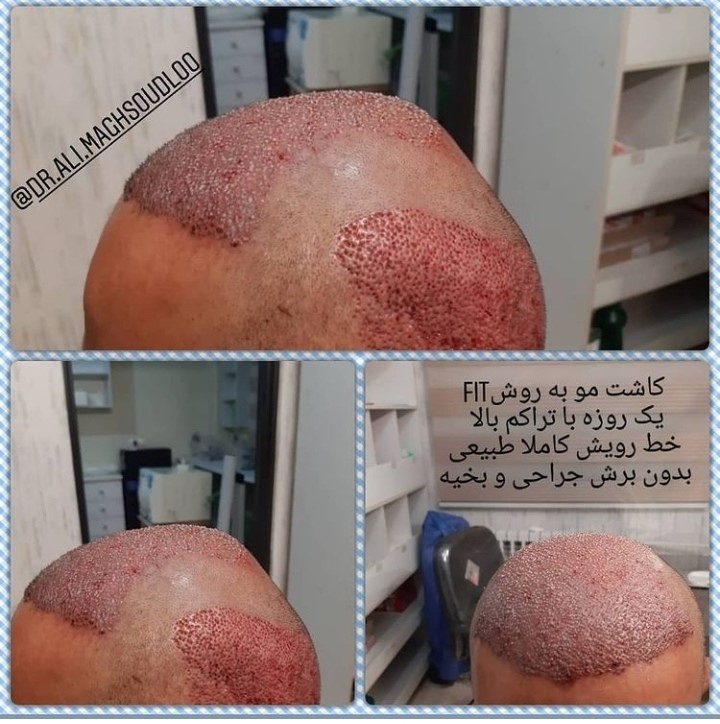 118 برتر ایران